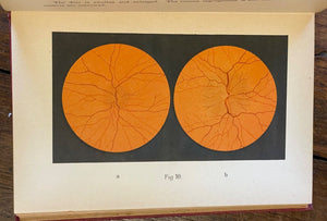 ATLAS OF OPHTHALMOSCOPY - Haab, 1st 1895 OPHTHALMOLOGY, MEDICAL, EYES, MALADIES