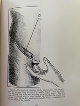 INJECTION TREATMENT OF HERNIA AND HYDROCELE - 1st 1938 - MEN'S MEDICINE HEALTH