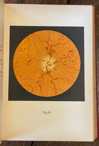 ATLAS OF OPHTHALMOSCOPY - Haab, 1st 1895 OPHTHALMOLOGY, MEDICAL, EYES, MALADIES