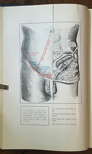 INJECTION TREATMENT OF HERNIA AND HYDROCELE - 1st 1938 - MEN'S MEDICINE HEALTH