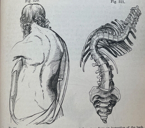 PRINCIPLES AND PRACTICE OF SURGERY - Smith, 1st 1863 - SURGICAL HEALTH DISEASE