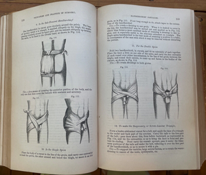 PRINCIPLES AND PRACTICE OF SURGERY - Smith, 1st 1863 - SURGICAL HEALTH DISEASE