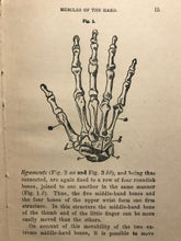 1873 - GYMNASTICS FOR THE FINGERS & WRIST - WARD-JACKSON - VICTORIAN ORTHOPEDICS